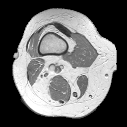 Leg In Cross Section